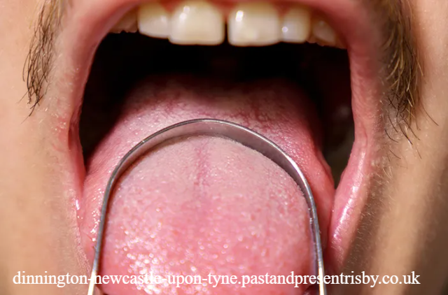 Begini Cara Membersihkan Lidah dengan Aman